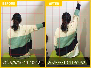 整体院 元 くまなん店/肩の挙上時痛の悩み