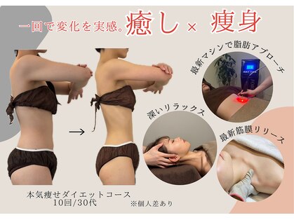 ルアバイアロ(Lua by Alo's)の写真