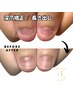 【その日に見た目改善】ハンド長さ出し深爪矯正＋クリア補強(通常¥22,000)