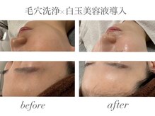 エミナル(EMINAL)の雰囲気(◇毛穴洗浄+美白ケア◇ 水光ツルスベ肌GET♪ )