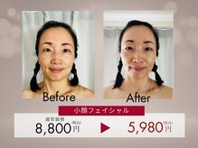 トゥルーフェイシャルヒーリング(TRUE FACIAL HEALING)