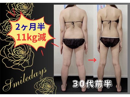 スマイルデイズ(Smiledays)の写真