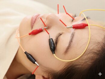 丸太町骨盤整骨院 鍼灸院/目元の不快に