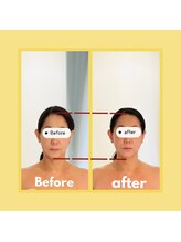 ビューティートワブルームサロン(Beauty Towabloom Salon)/顔も頭も小さく変身！