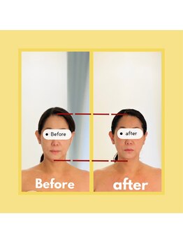 ビューティートワブルームサロン(Beauty Towabloom Salon)/顔も頭も小さく変身！