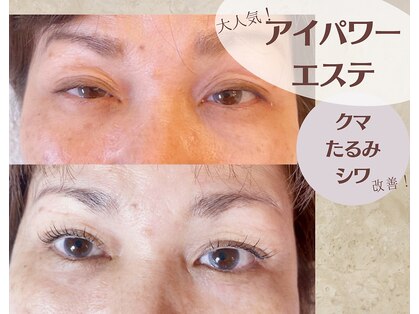 ディンプル(DIMPLES)の写真