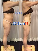 ボディエステティック アクアオーラ 富山店/ウエストー２７．５ｃｍ