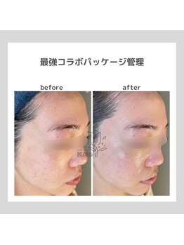 ポムハヌル(pom.haneul)/韓国肌管理室