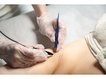 サロンロンウーマン(SALON RON woman)/脇脱毛