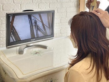 ノーブルの写真/『頭皮トラブル改善』マイクロスコープで頭皮診断を行います◎誰にも言えない悩みを解決しませんか♪
