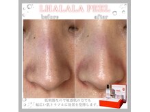 メイリリー(Meilily)の雰囲気（韓国肌管理♪ララピール取り扱い正規店◎）
