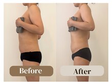 アムール(Amour)/身体が薄く｜40代女性