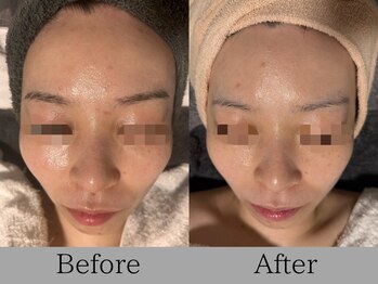 ルミライズ(lumirise)/〈7回目での効果〉