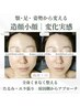 小顔矯正×美容整体＆姿勢改善｜造顔小顔で印象が変わる変化へ