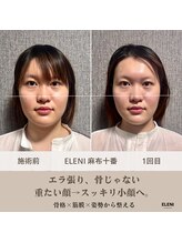 エレーニ 麻布十番(ELENI)/1回でここまで変わる