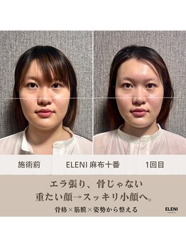 エレーニ 麻布十番(ELENI)/1回でここまで変わる