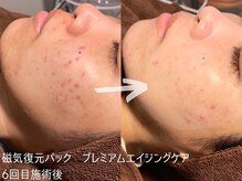 ルーナジェーナ(Luna llena)/池袋　エステ　ルーナジェーナ