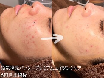 ルーナジェーナ(Luna llena)/池袋　エステ　ルーナジェーナ