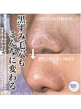 エリス(ELISSE)/フェイシャルワックス