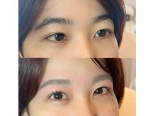 エテミー(etemy)/1日で垢抜けset