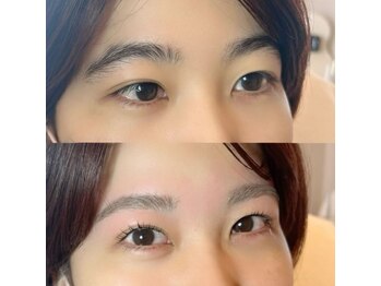 エテミー(etemy)/1日で垢抜けset