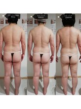 RiとBiのたまご/（BODY）　最新機セルケア