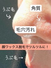 キラン(KIRAN)/フェイスワックス脱毛