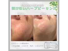 メイリリー(Meilily)の雰囲気（大人気ハーブピーリング◎クリスティーナ取扱正規店）