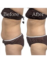 プランツ(PLANTS)/４0代／１回／お腹ケア