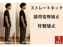 首猫背、慢性腰痛に驚きの変化！ストレートネックの改善にも◎