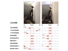 女性専用整体サロン　ベル 岩国店/ 【50代】姿勢Before After