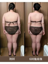 ルマ(Rumah)/凝り固まった巻き肩を脂肪分解