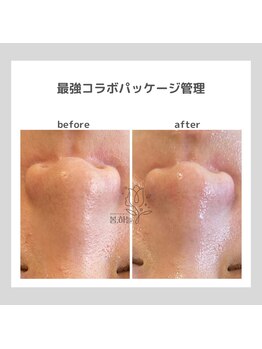 ポムハヌル(pom.haneul)/韓国肌管理室