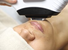 シューラディアント(ShuRadiant)/メンズ脱毛／ヒゲ脱毛３箇所