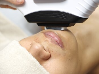 シューラディアント(ShuRadiant)/メンズ脱毛／ヒゲ脱毛３箇所