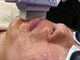 エール(AeLL)の写真/【男性も美肌を求める時代】面倒な毎日の自己処理から解放!最新機器ルミクス脱毛(SHR式)で痛みに弱い方も◎