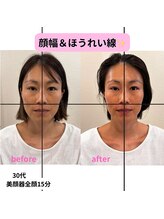 ベルソー鍼灸整体院(berceau鍼灸整体院)/