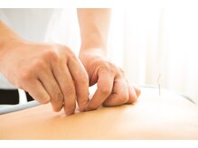 北堀江鍼灸整骨院の雰囲気（鍼が怖いや響くのが好きなどお好みをお伝えください。）