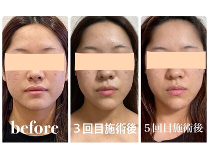 クリーム 金沢店(Cream)の写真