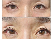 バンビちゃんのお目目 熊本店/目が変わればお顔の印象も変わる