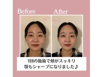 ピオニー(Peony)の写真