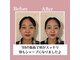 ピオニー(Peony)の写真