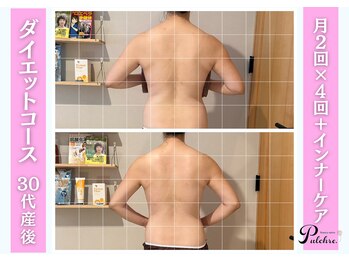 プルクレ 常磐町店(Pulchre)/ビフォーアフター♪