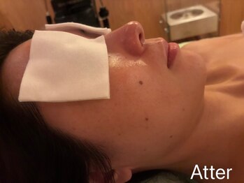 凪 横浜/夏の毛穴ケア