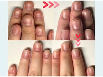 クウ(KUU)/自爪風で深爪→美爪まで