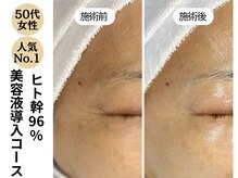 ディレイア ザ コスメ 有楽町マルイ店(direia the cosme)/ツヤ/目元のしわ/たるみ[有楽町]