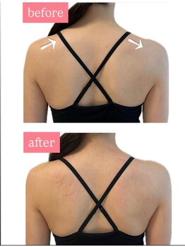 グリッター ショウナン(glitter. SHONAN)/美しい体作り★before/after藤沢