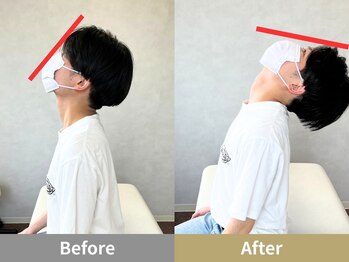 せなかのはね 井尻店/20代女性　首こり　猫背　頭痛