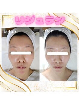 グラシア(gracia)の写真/30・40代から気になり始めるハリ不足・乾燥・小ジワ・毛穴に。