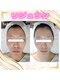 グラシア(gracia)の写真/30・40代から気になり始めるハリ不足・乾燥・小ジワ・毛穴に。